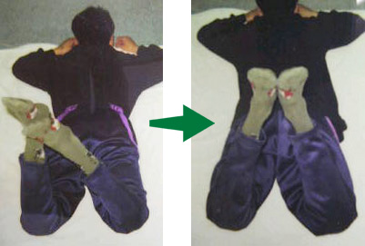 施術前後の写真